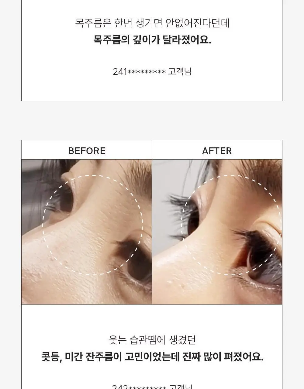 [주름리프팅] 퍼셀 82% 하이-도즈 펩타이드 콜라겐 앰플 20ml 상세페이지 8